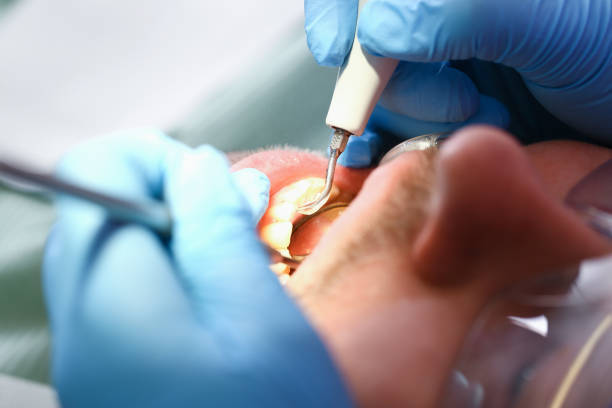 Best Emergency Care for Gum Disease in Blue Jay, OH